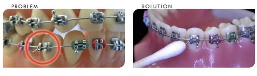 非常时期非常处理,非常时期全力守护