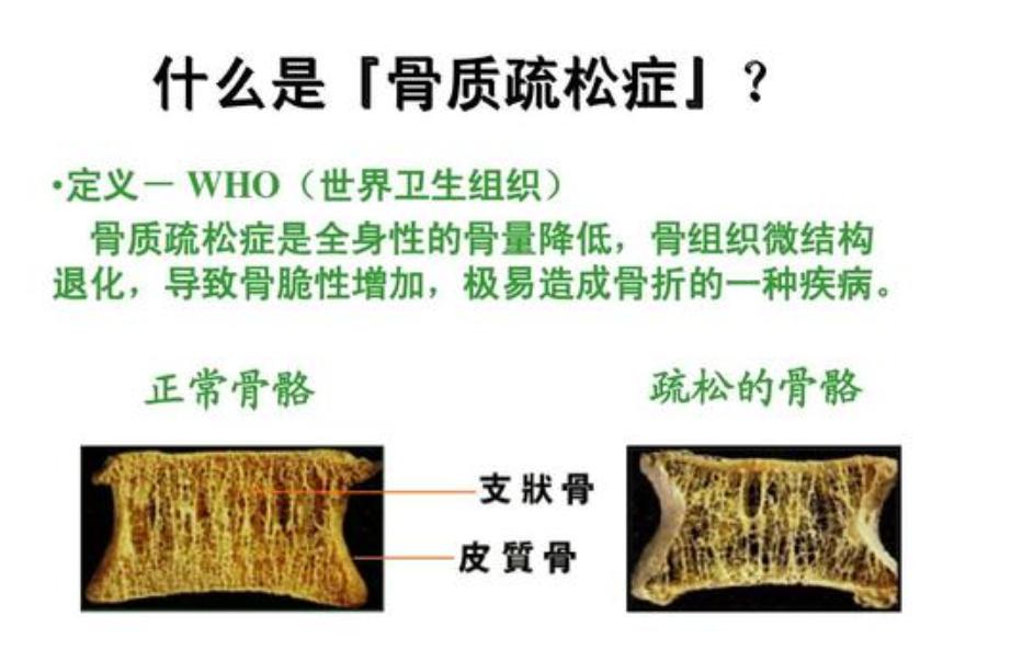 骨头缺钙多长时间能补起来,人体骨头缺钙用什么食补最好