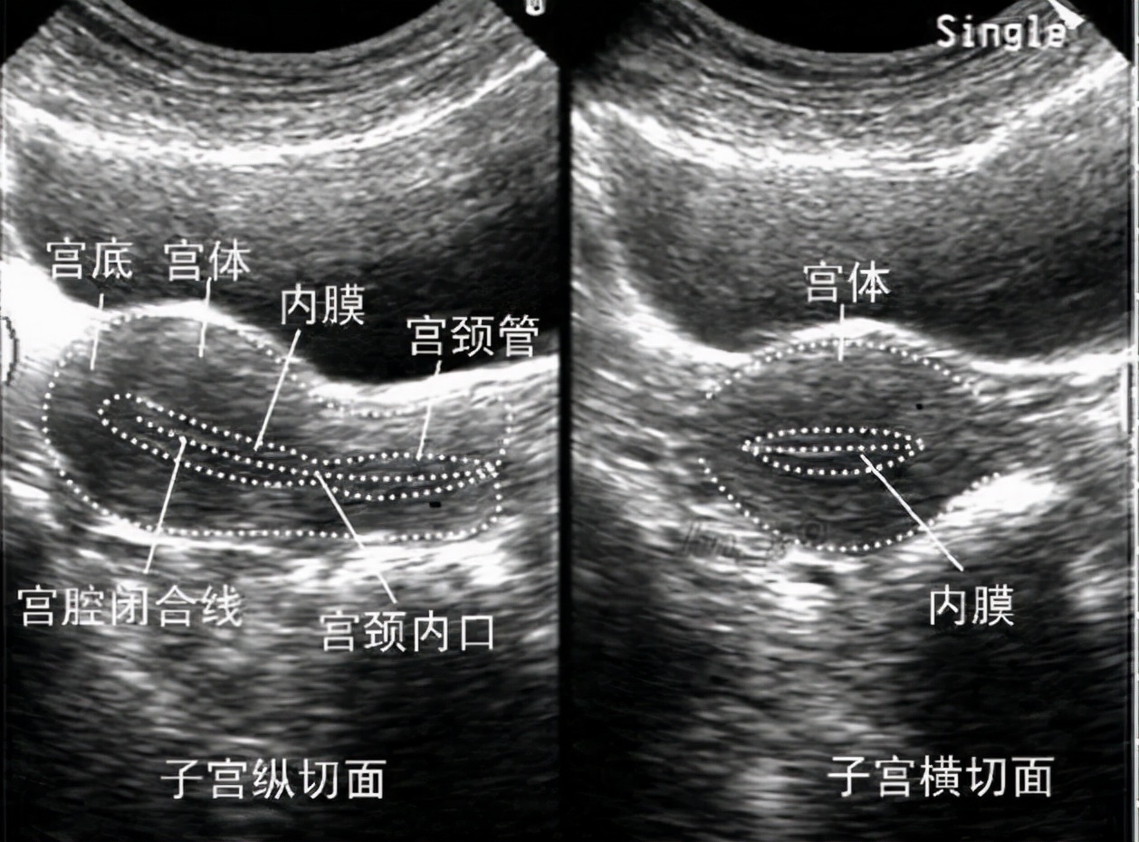 子宫内膜薄，试管做了9次都没成功，我该怎么办？