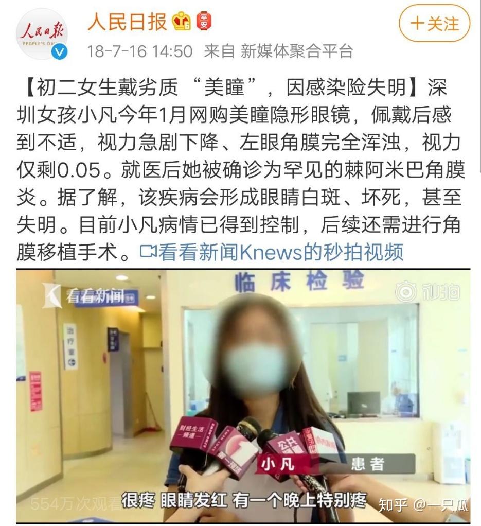 戴美瞳和不戴美瞳的区别 (戴美瞳会不会离不开美瞳)