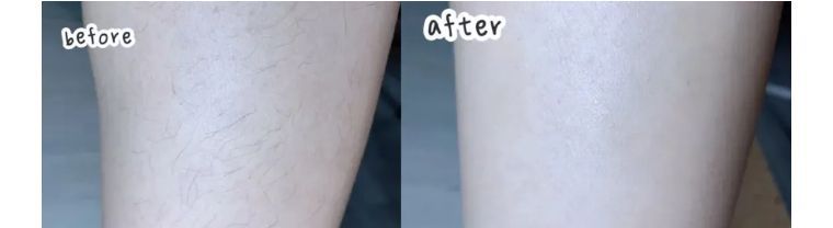 j-style脱毛仪,j-style脱毛仪怎么样