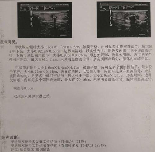 发现甲状腺结节恶性怎么办,甲状腺结节增长过快是甲状腺癌吗