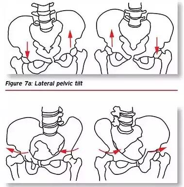 第三次做骨盆调理,稳定骨盆最简单的办法
