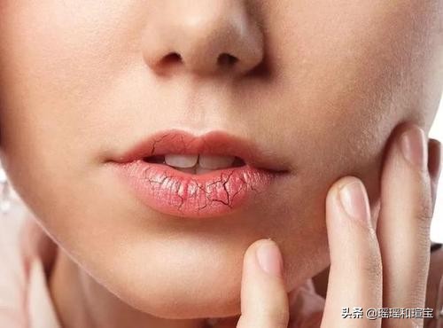 这5种坏习惯很多人常做,哪些坏习惯会使嘴唇变厚