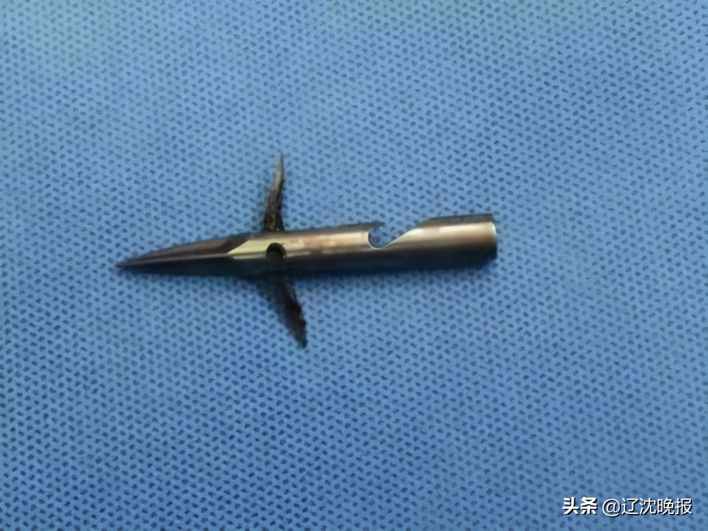 男子吃鱼被刺破大动脉,男子用鱼枪射人