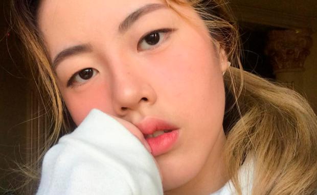 *血丝红**导致的脸红，这里有5个方法改善，可以有效缓解肤质