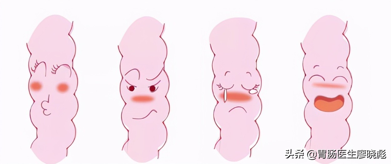 结肠黑变病介绍,为什么会患结肠黑变病