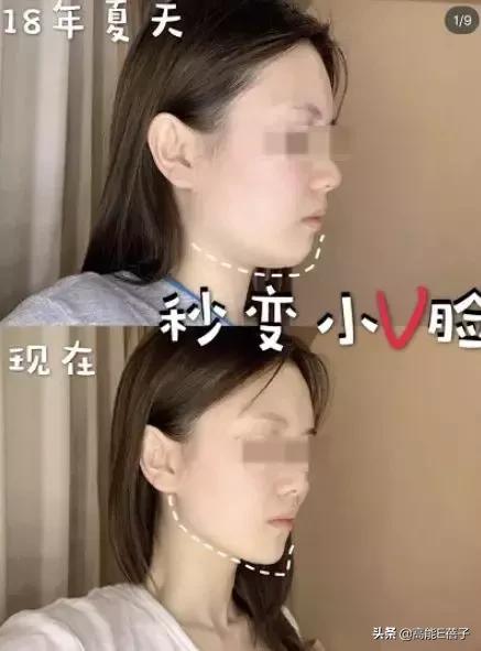 脸大真的不如脸小的好看吗,脸小真的显瘦吗