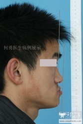 正畸医生如何指定方案的,正畸医生怎么说