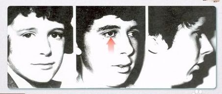 宝宝嘴里有白色的小点叫什么,一个月宝宝口腔上颚白色的是什么