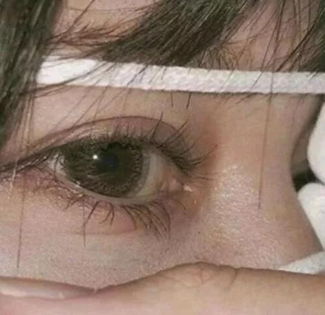 眼睛太小了怎么可以把它变大一点,小孩子眼睛太小怎么自然变大