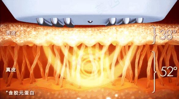 打完玻尿酸和瘦脸针的注意事项,打完玻尿酸和瘦脸针应该注意什么