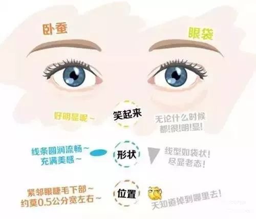 手术去眼袋安全吗,去眼袋手术多少钱