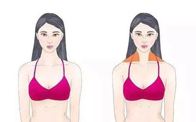 圆肩特别严重怎么办,圆肩怎么改善最有效的方法