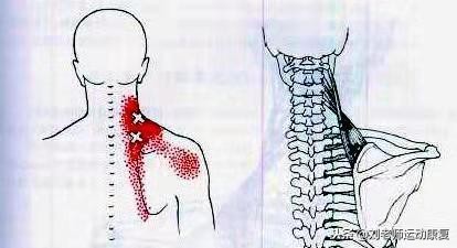 上背疼怎么康复,下背疼痛怎么康复训练