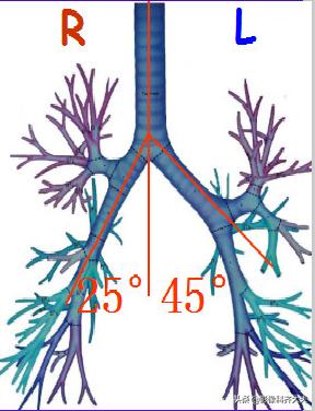 孩子支气管异物ct能查出吗,儿童支气管异物诊断方法
