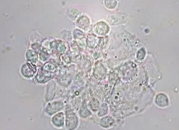 妇幼保健院查白带流程,妇幼检查白带