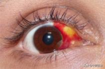 被玩具枪打伤的孩子,小孩被玩具枪伤