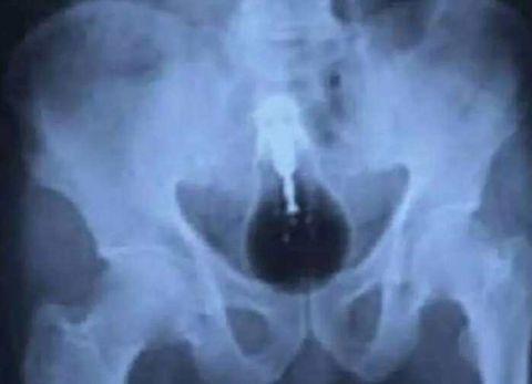 不作死就不会死看看你中了几条,不作死就不会死让人看的头皮发麻