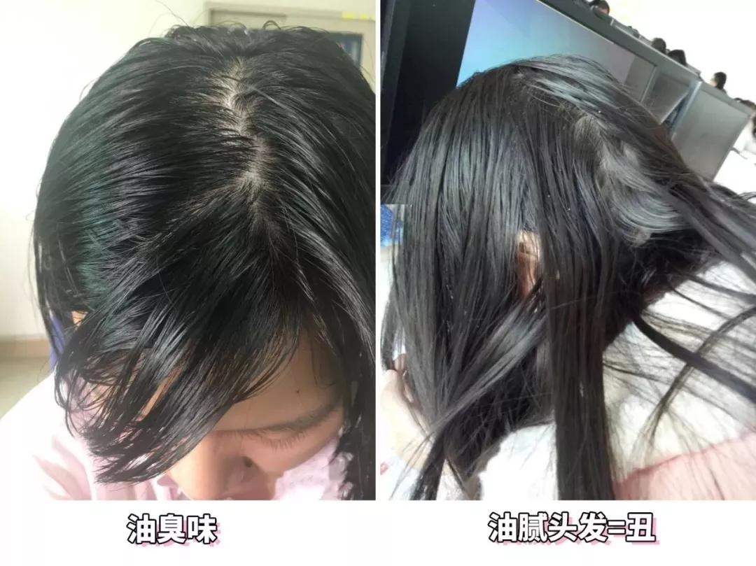 有什么适合油头的洗发水,洗头发不油且蓬松的洗发水