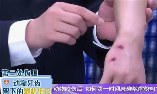伤口没有出血要消毒吗,被狗咬了没有流血要打狂犬疫苗吗