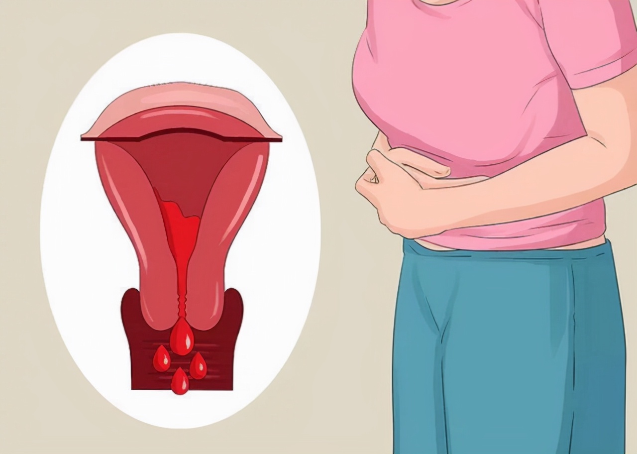 女性来例假时，有像“肉”一样的血块，是咋回事？看完涨知识