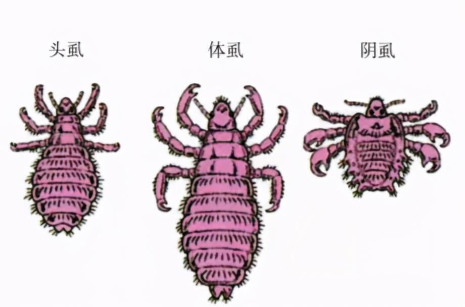 阴虱为什么会长在小孩眼睫毛,阴虱长到小孩眼睛里面去了