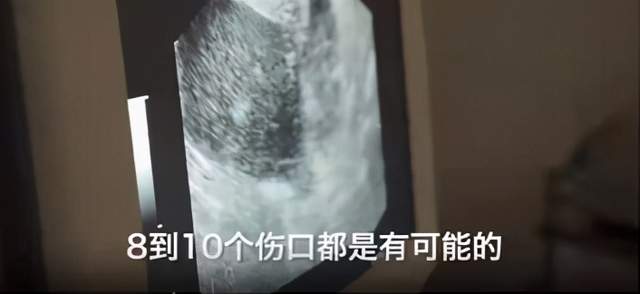 一颗卵子值100,卵子捐卵