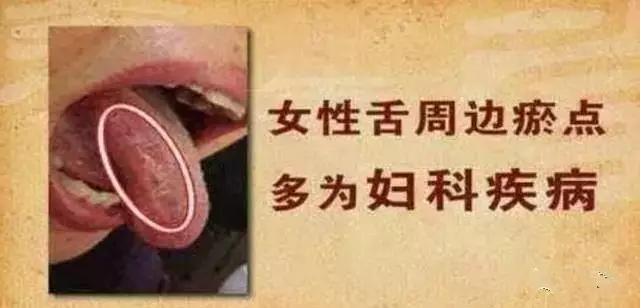 老中医提醒舌头4种异常,舌头一旦出现这个信号马上找中医