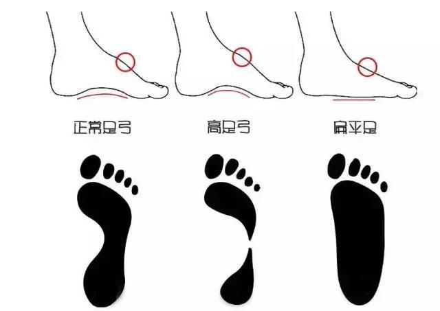 哪个品牌鞋子可以根据脚型定制,买鞋子穿才好看