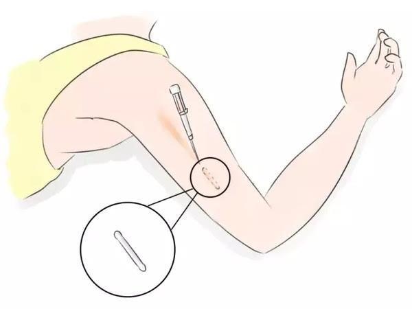 安全期自测方法,安全期怎么检测最有效