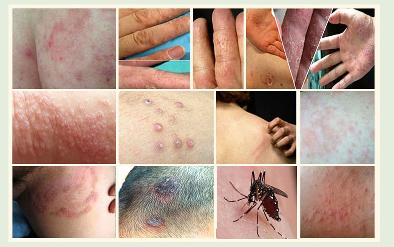 皮肤问题反复出现是怎么回事,皮肤瘙痒反复发作是什么原因