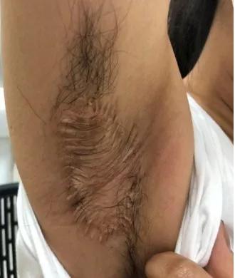 青岛第八人民医院全部科室,青岛第八人民医院皮肤科