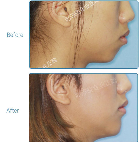 杭州口腔医院整牙,杭州整牙医生怎么选