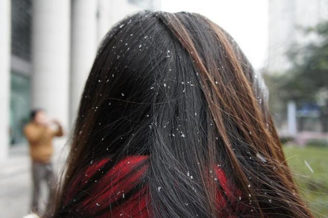 头皮屑是怎么产生的该怎么消除,头皮屑为什么多有什么办法解决