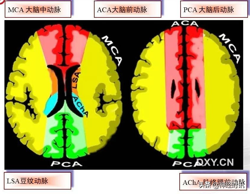 脑动脉解剖学讲解,基底节区脑血管解剖