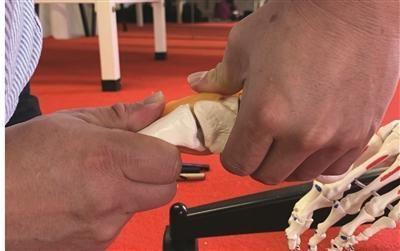 跑步脚踝上方10公分疼痛,跑步脚踝肿痛怎么消除