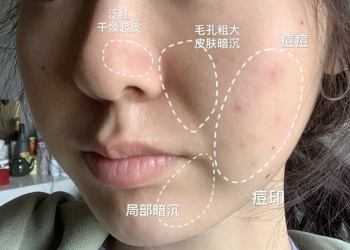 2022年6款性价超高的国货护肤品,2020年40-50岁平民护肤品推荐