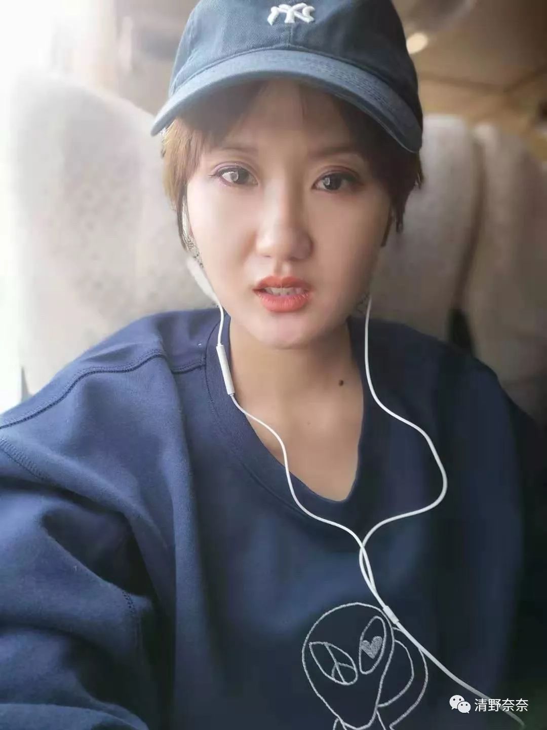 四十岁有法令纹川字纹医美项目,法令纹和鱼尾纹用医美怎么处理