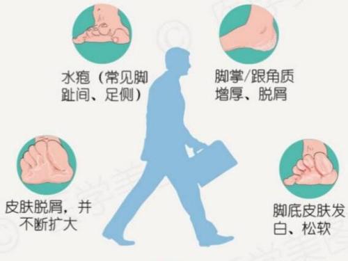 引起脚跟疼痛的原因有哪些,引起脚痒的四大诱因你都知道吗