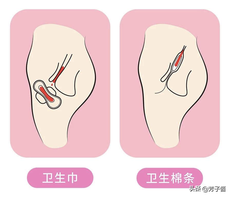 第一次用卫生棉条可以用量大的吗,卫生棉条第一次使用会不习惯吗