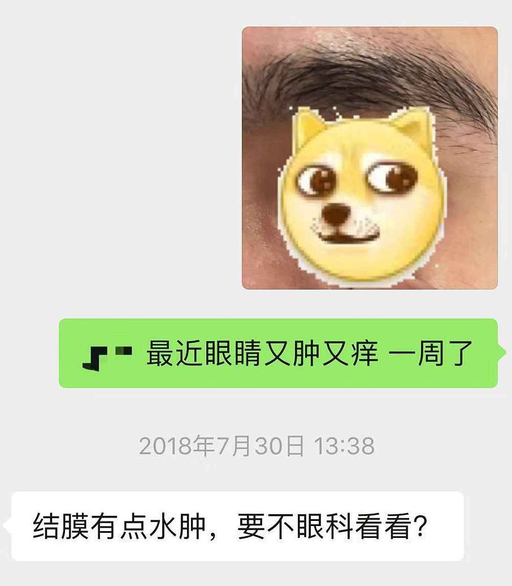 隐形眼镜有散光加近视,近视度数高有散光戴隐形眼镜