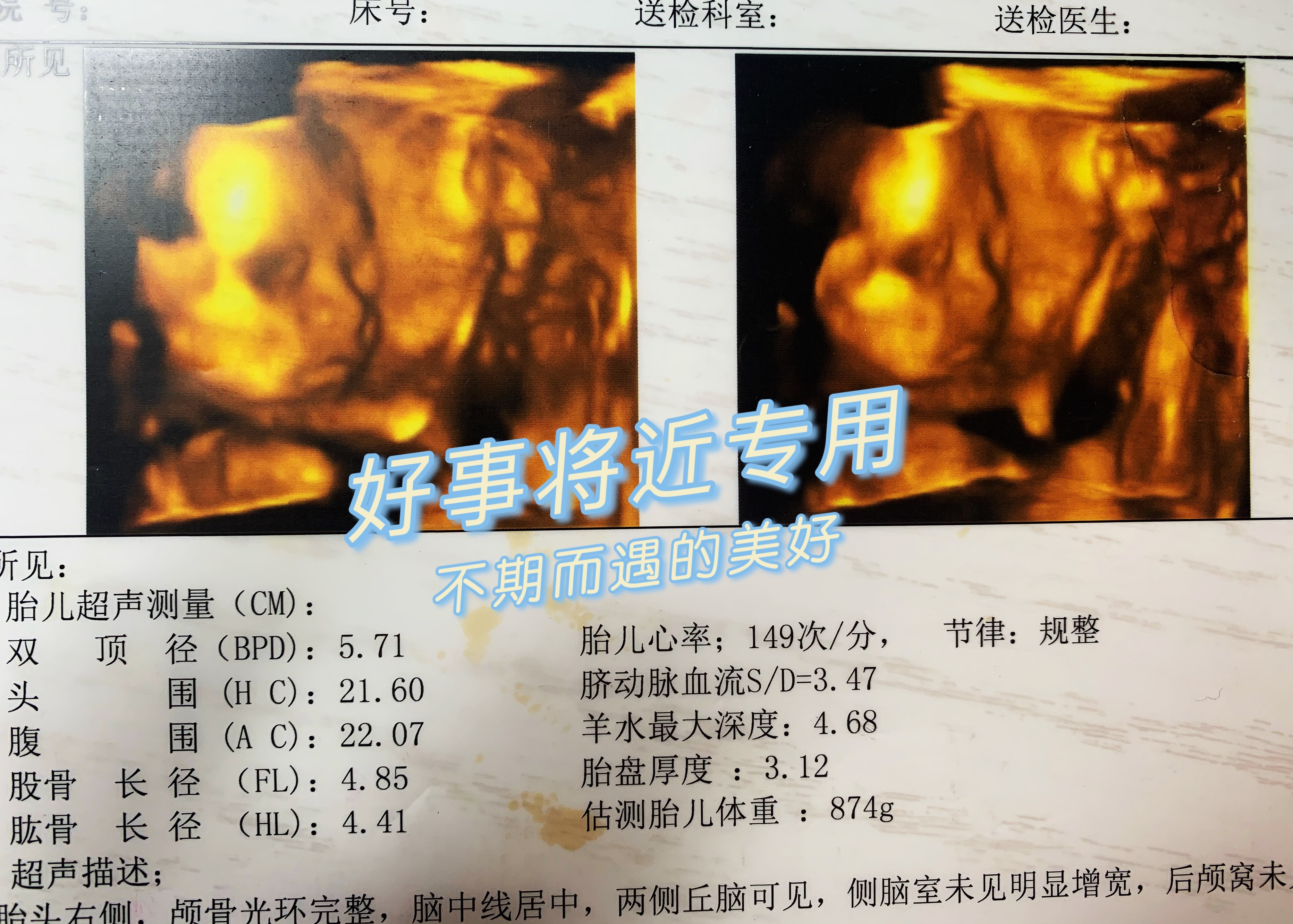 怀孕16周羊水破了见红能否保胎,26周羊水早破保胎成功几率