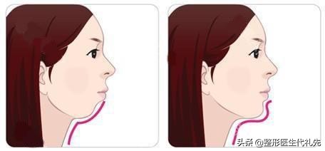 怎样才能拥有完美的下颌线,怎样让自己的下颌线更明显