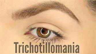 拔毛癖需要治疗吗,怎么能戒掉拔毛癖