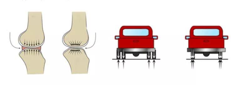 打篮球预防半月板损伤,半月板损伤治疗预防药物