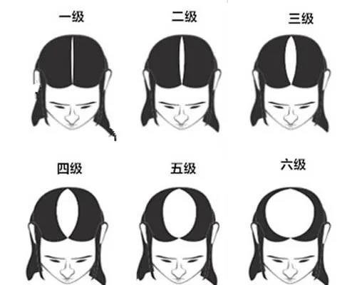 发量增多的实用小技巧,发量少怎么拯救