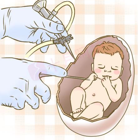 「讨论」做产检时发现胎儿畸形，该怎么办，到底生还是不生？