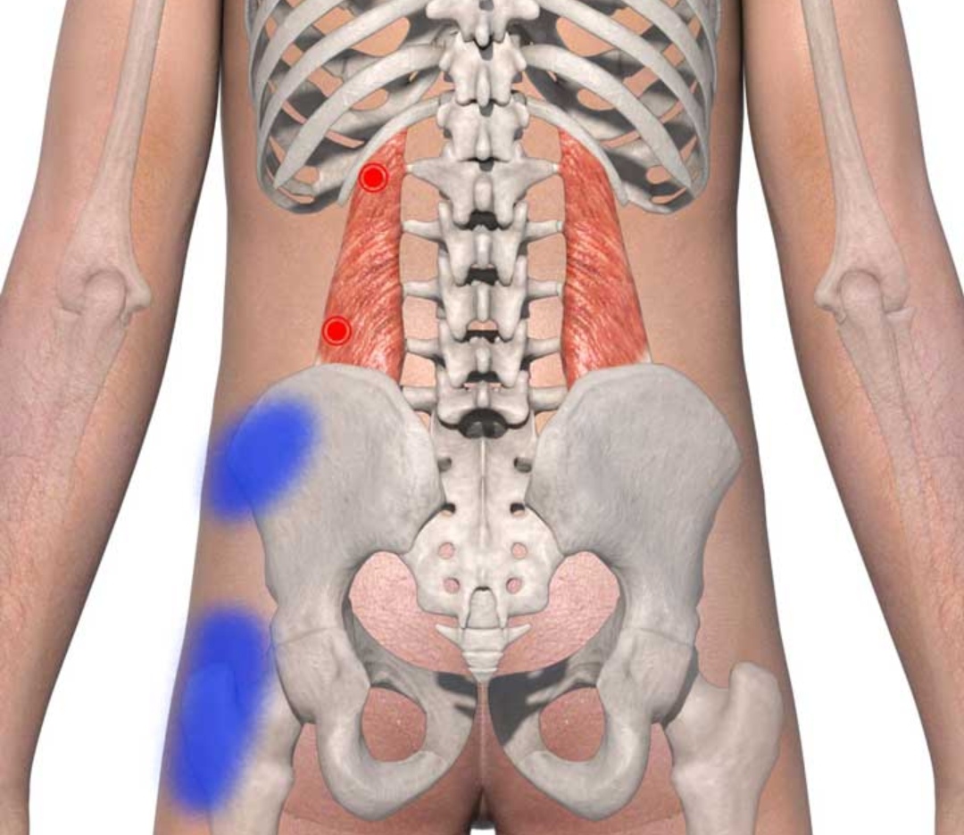 腰疼一走路就腰直不起来,腰痛可以弯腰但直不起来