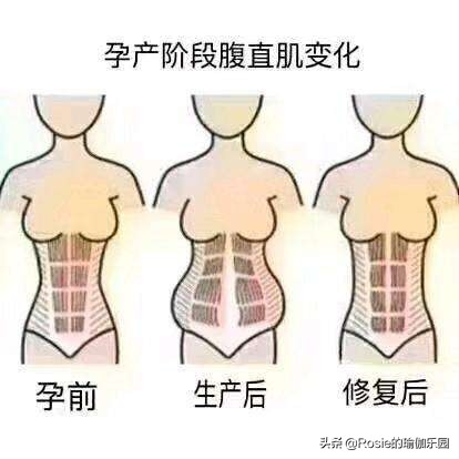 产后妈妈肋骨外翻外扩的危害,肋骨外翻是什么原因造成的女性